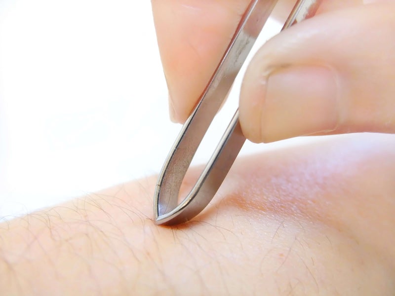 発毛する仕組みとは！？