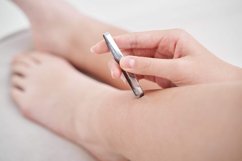 5歳からスタート? 「子供脱毛」が増える理由と親心