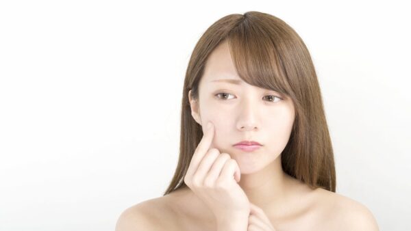 ニキビがあっても脱毛はできる？脱毛とニキビの関係